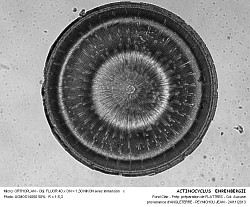ACTINOCYCLUS__EHRENBERGII - 4.jpg