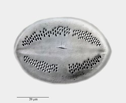 Cocconeis-eocaenica.jpg