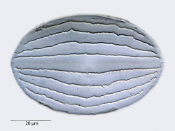 Cocconeis-pelucida-nankoorensis.jpg