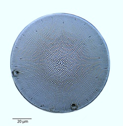 Coscinodiscus-jonesianus-commutatus.jpg