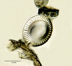 Cyclotella-meneghiniana-K.jpg