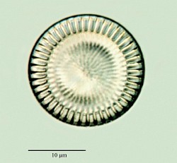 Cyclotella-meneghiniana.jpg