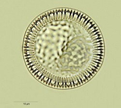 Cyclotella-striata.jpg
