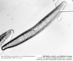 EPITHEMIA_ADNATA_varPORCELLUS_Kutzing - 9.jpg