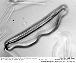 EUNOTIA_BIDENTULA - 2.jpg