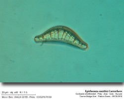 Epithemia_smithii_carruthers.jpg