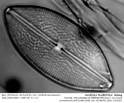 NAVICULA_PLACENTULA__Kutzing.jpg
