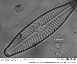 NAVICULA_SCLESVICENCIS.jpg