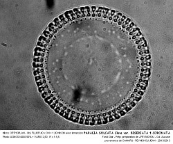 PARALIA_SULCATA_Cleve_var_BISERIATA_fCORONATA - 2.jpg