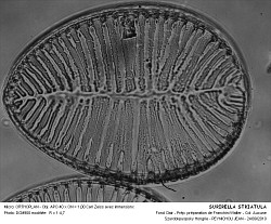 SURIRELLA_STRIATULA-2.jpg