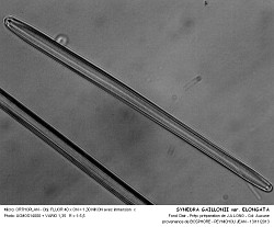 SYNEDRA_GAILLONII_var_ELONGATA.jpg