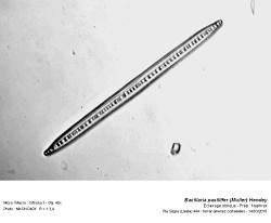 bacillaria_paxillifer_muller_hendey.jpg