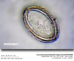 cocconeis_placentula_ehr_hypovalve_ref_40429.jpg