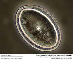 cocconeis_placentula_ehr_hypovalve_ref_40448.jpg
