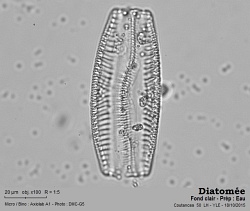 diatomee_Coutances_spet_2015_100x_BF.jpg
