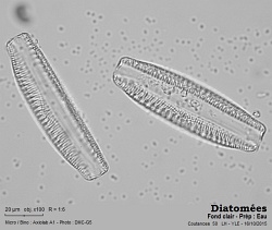diatomees Coutances sept2015 100x BF nb filtre vert.jpg
