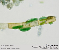 diatomees_Coutances_sept_2015_40xBF_st8_Bleu_de_cresyl.jpg