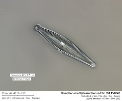 gomphonema_sphaerophorum_ehr__ref_tv0343.jpg