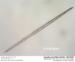 synedra_ulna_nitzsche_ehr___ref_40103.jpg