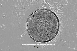 tmp_15924-Actinocyclus subtilis-851056318.JPG