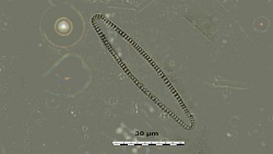 tmp_19039-Synedra tabulata865702762.JPG